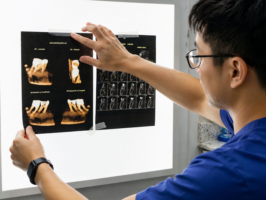 Dentist reviewing dental X-rays on a light board.